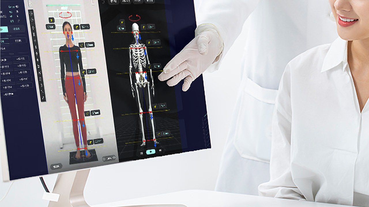 A clinician pointing at an ExBody posture analysis on screen, with the patient photo beside a skeletal overlay